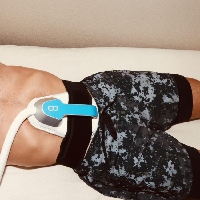 TrimSculpt Treatment